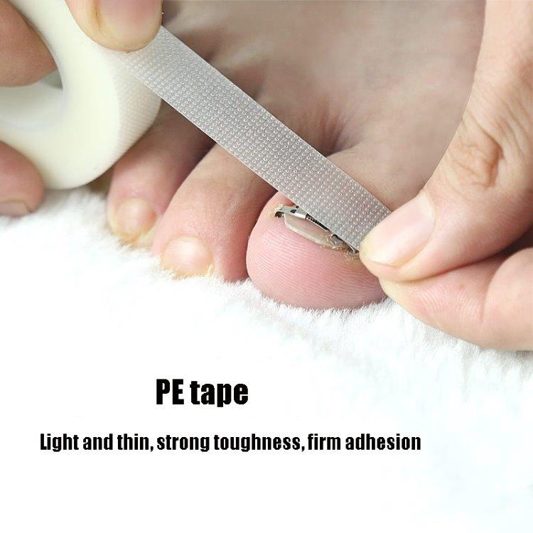 Ortopedisk nagelkorrigering