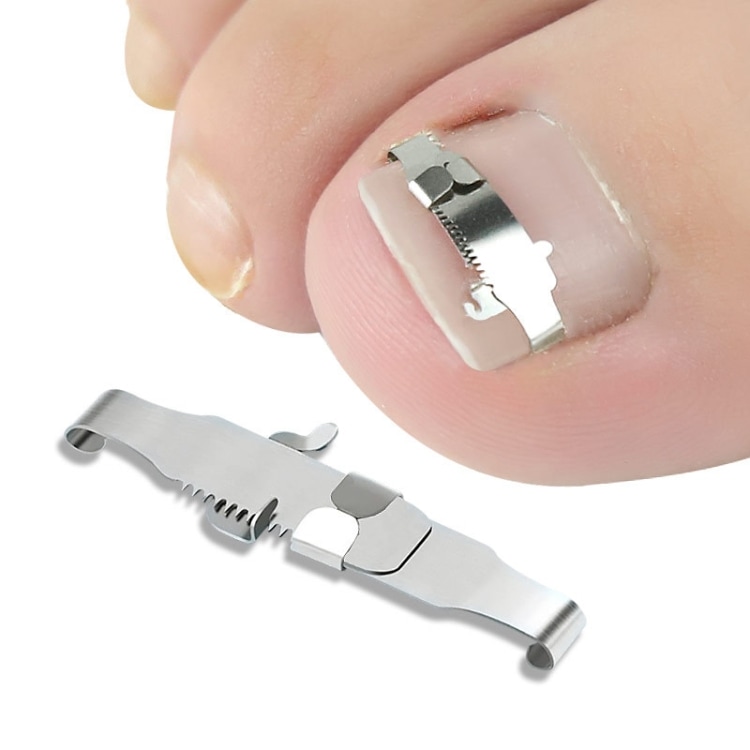 Ortopedisk nagelkorrigering
